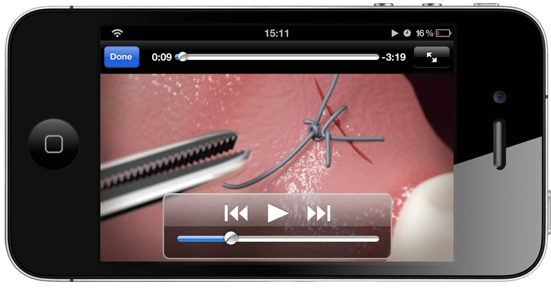 3D-Animation für App | Nahttechniken in der Dentalchirurgie